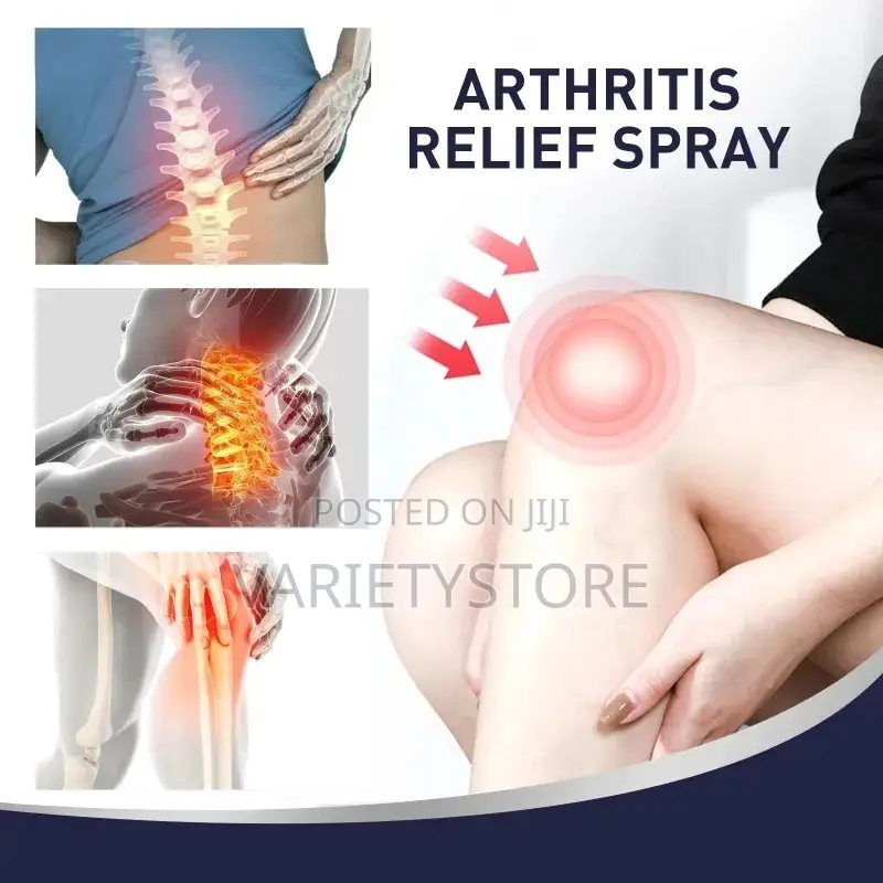Arthritis Relief Spray