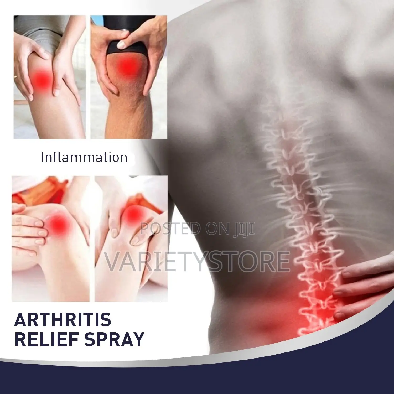 Arthritis Relief Spray