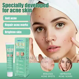 Photo - Hbersty Acne Remover Creamy