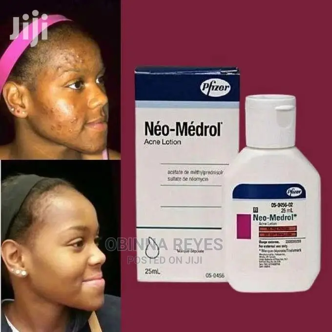 Néo - Médrol