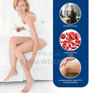 Varicose Veins Spray