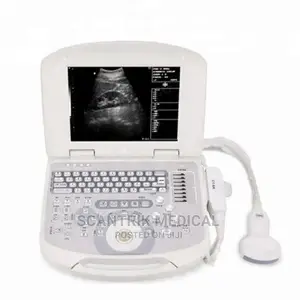 Portable Ultrasound Machine