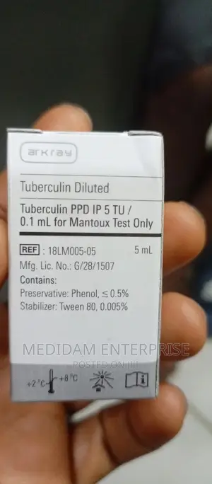 Mantoux Tuberculin