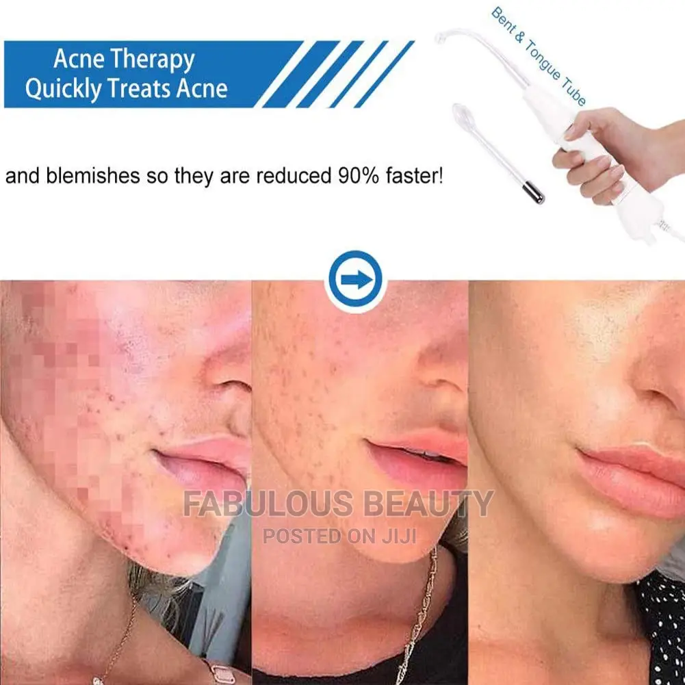 High Frequency Facial Machine - CGBF