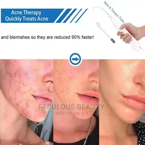 High Frequency Facial Machine - CGBF