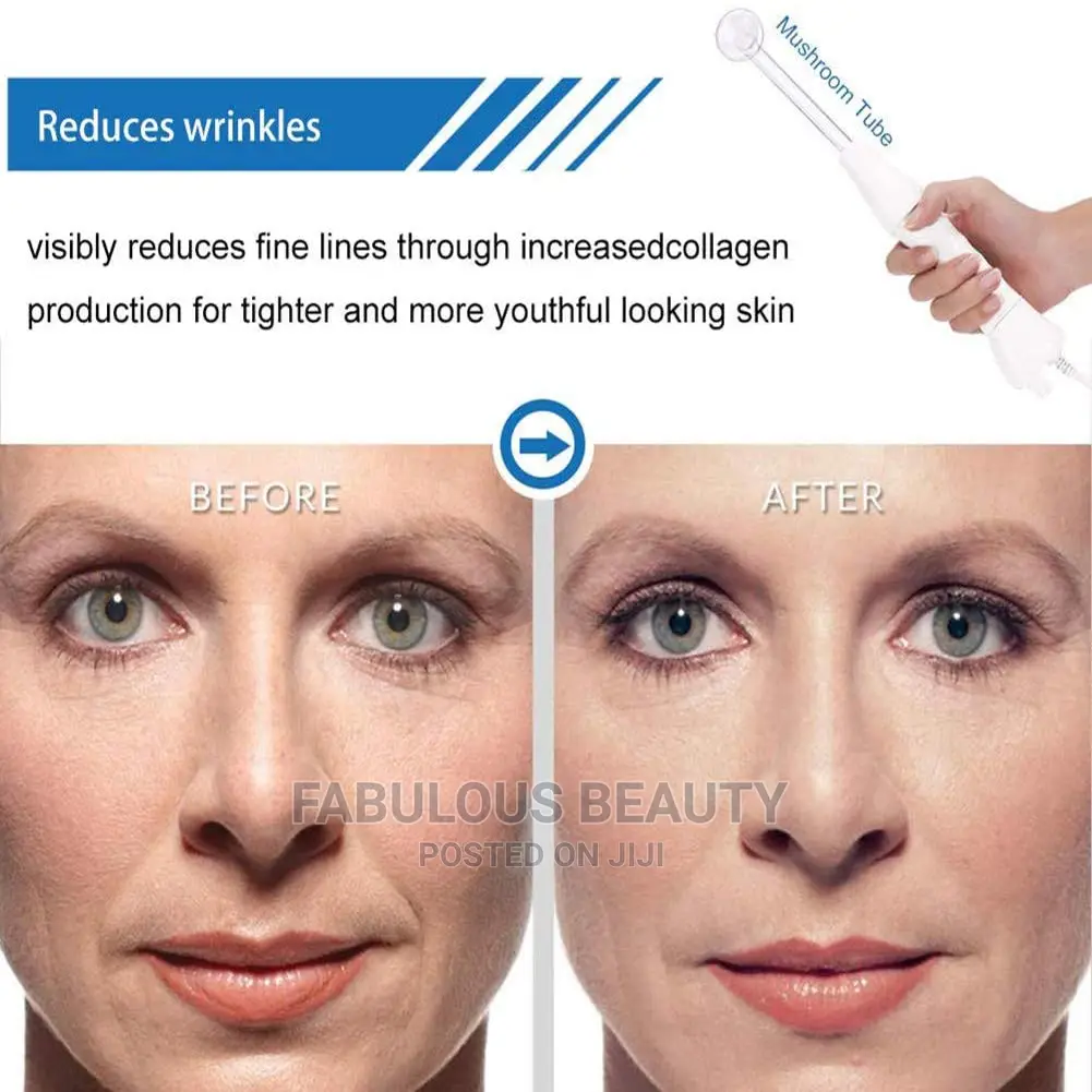 High Frequency Facial Machine - CGBF