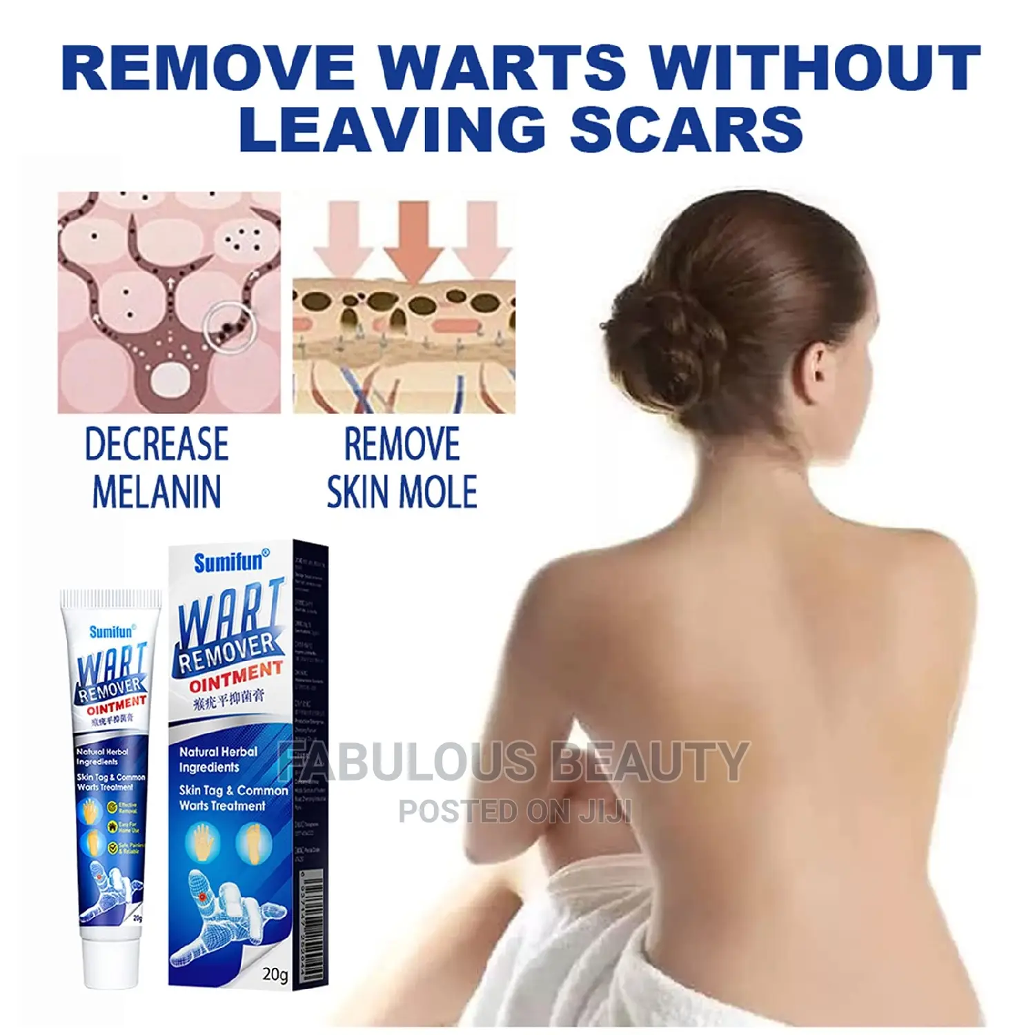 Wart Remover Ointment,20g