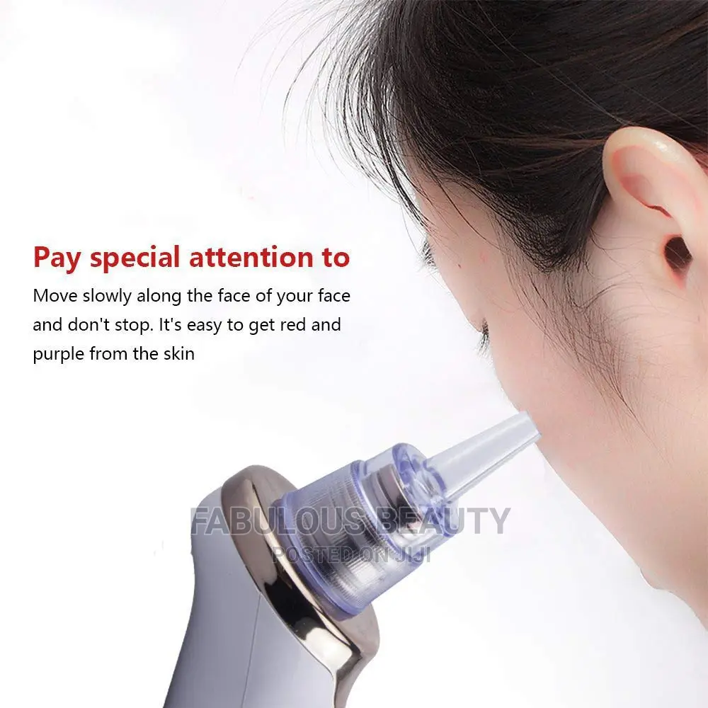 Electric Blackhead Remover Vacuum.