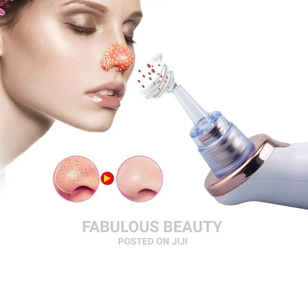 Electric Blackhead Remover Vacuum.