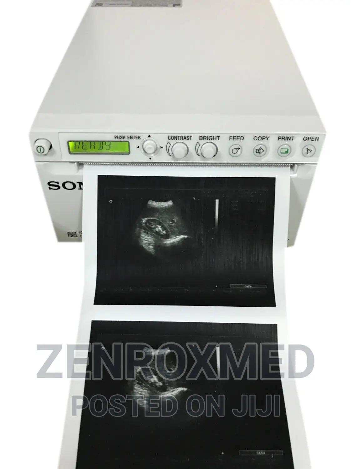 Sony Thermal Printer