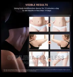 SPA Stretch Marks EMS RF LED Stubborn Body Fat Removal Iron