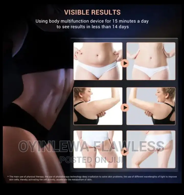 SPA Stretch Marks EMS RF LED Stubborn Body Fat Removal Iron