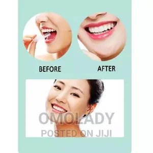 Alignment Teeth Trainer - A1