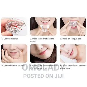 Teeth Trainer Alignment - A2