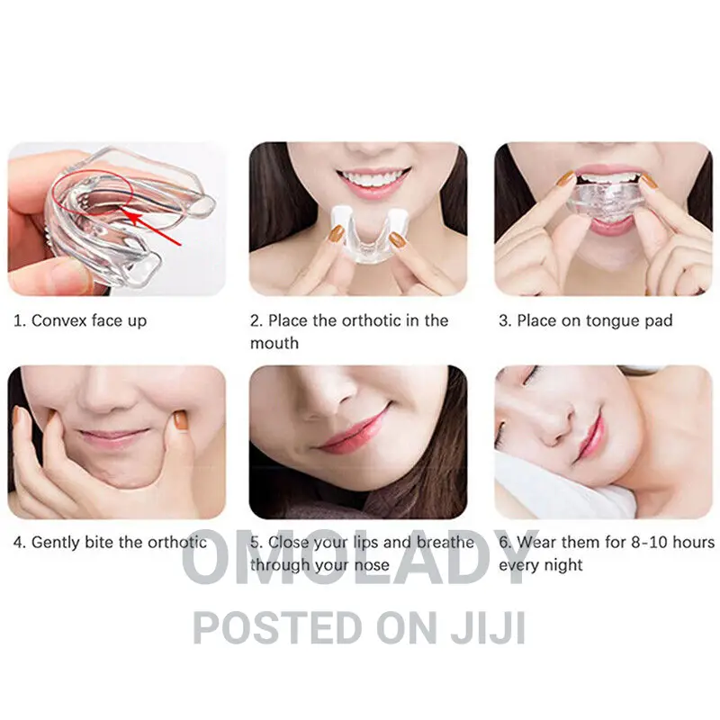 Teeth Trainer Alignment - A2