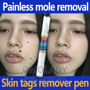 Eelhoe Tag Wart Remover - 2pc