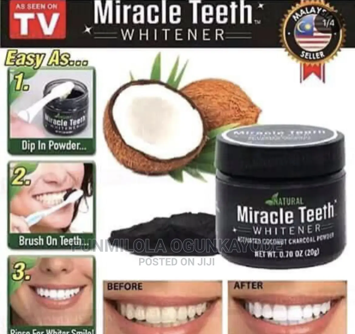 Miracle Whitening Teeth