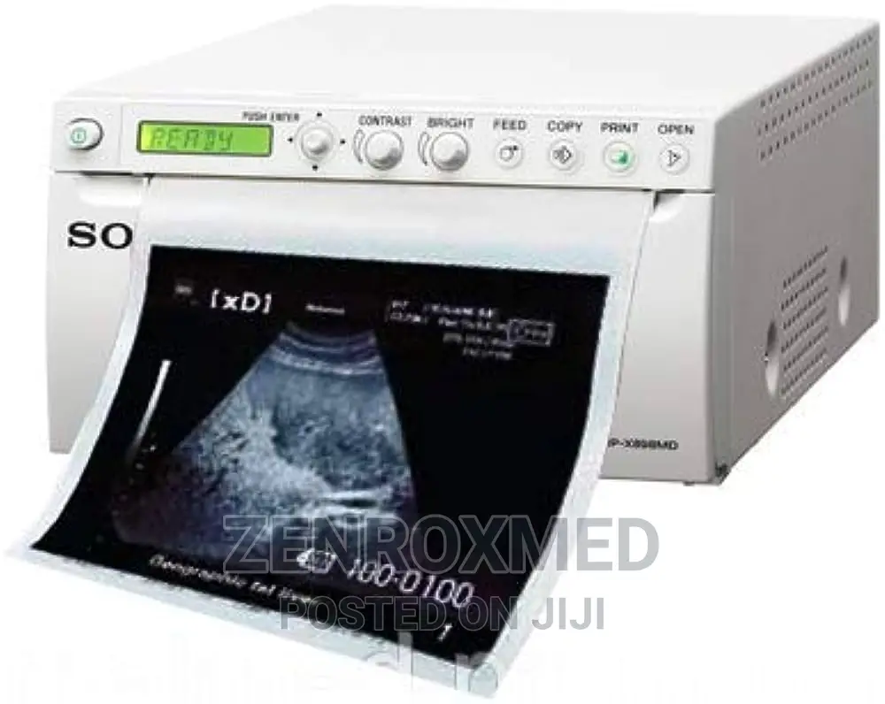 Ultrasound Printer