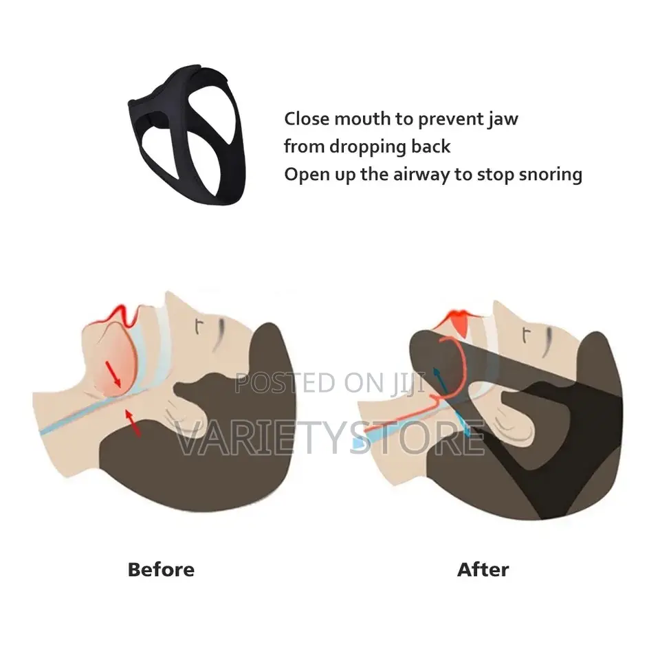 Anti Snoring Chin Strap for Snoring Solution