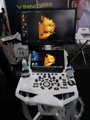3d/4d Ultrasound Color Doplar With High Resolution