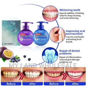 5x Powerful Stain Removal Baking Soda Toothpaste
