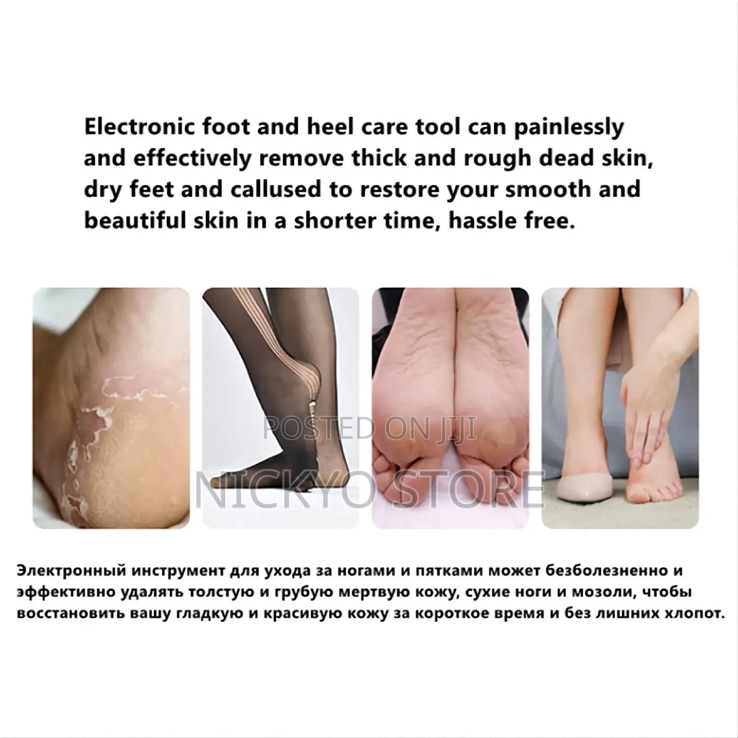 Rechargeable Callus Remover