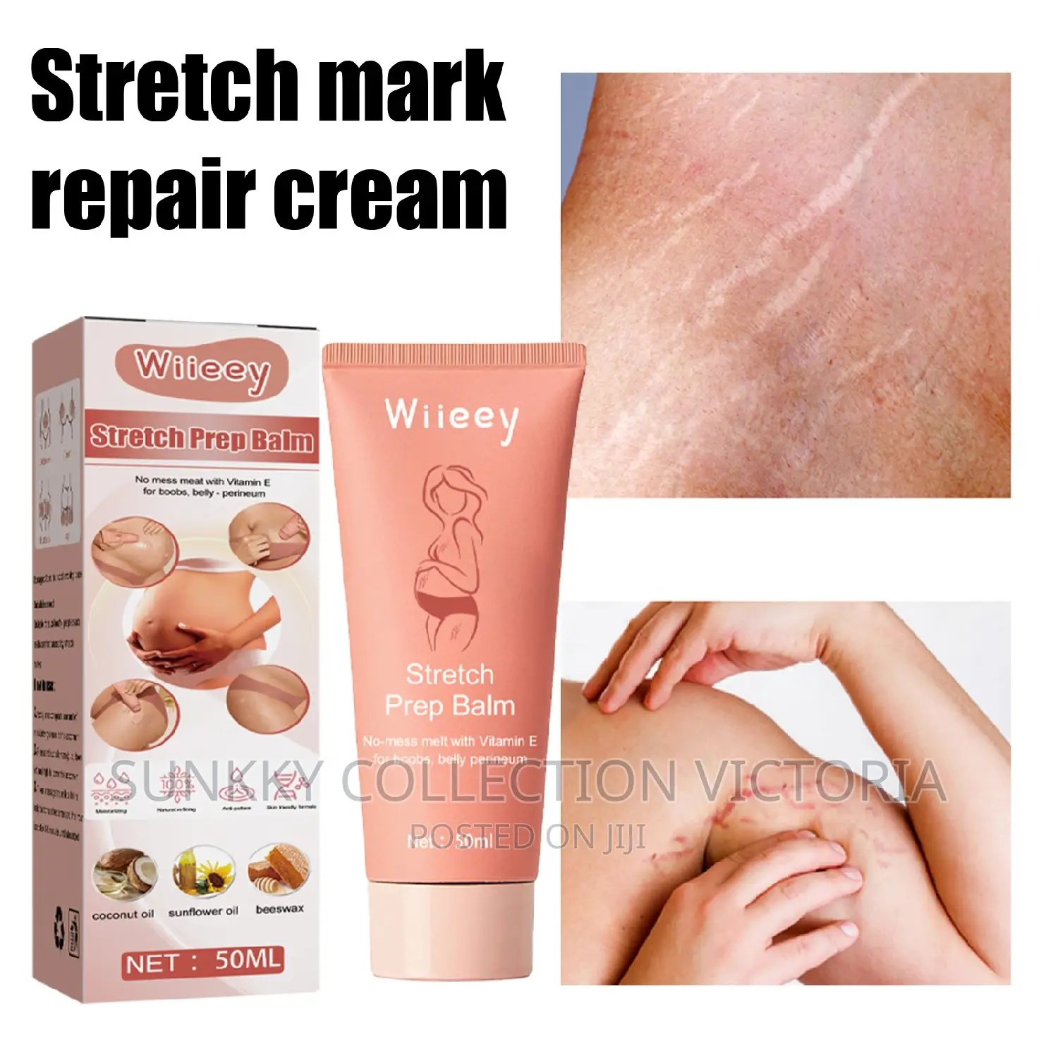 Postpartum Stretch Mark Repair Cream