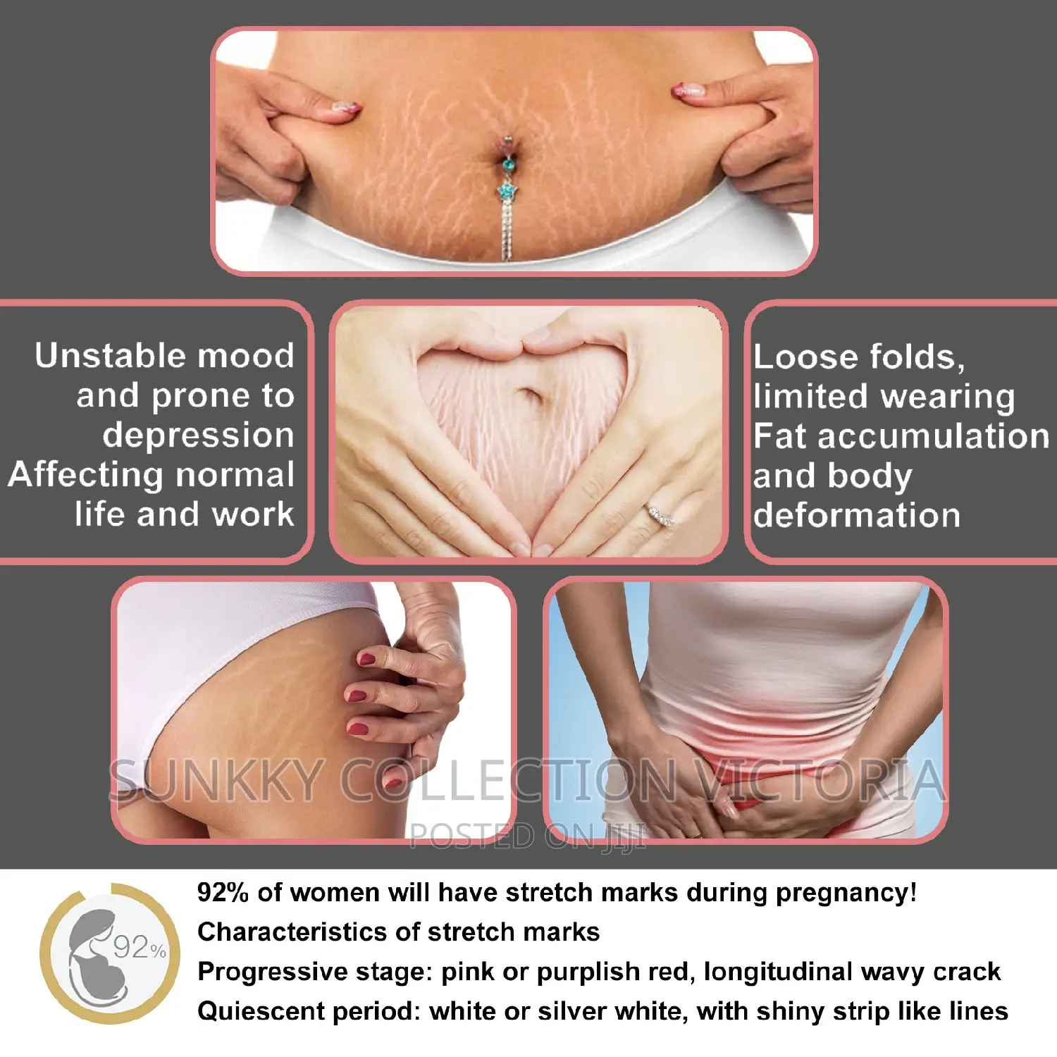 Postpartum Stretch Mark Repair Cream