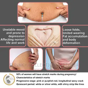 Postpartum Stretch Mark Repair Cream