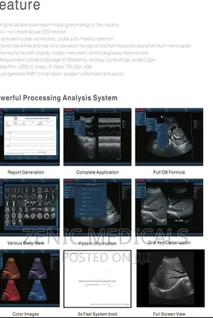 Scan Machine