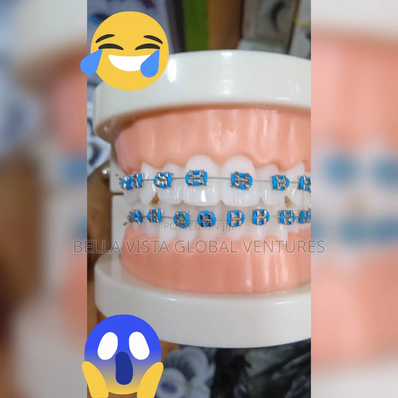 Teeth Fashion Braces