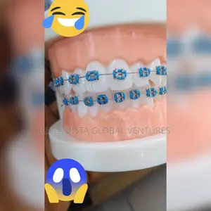 Teeth Fashion Braces