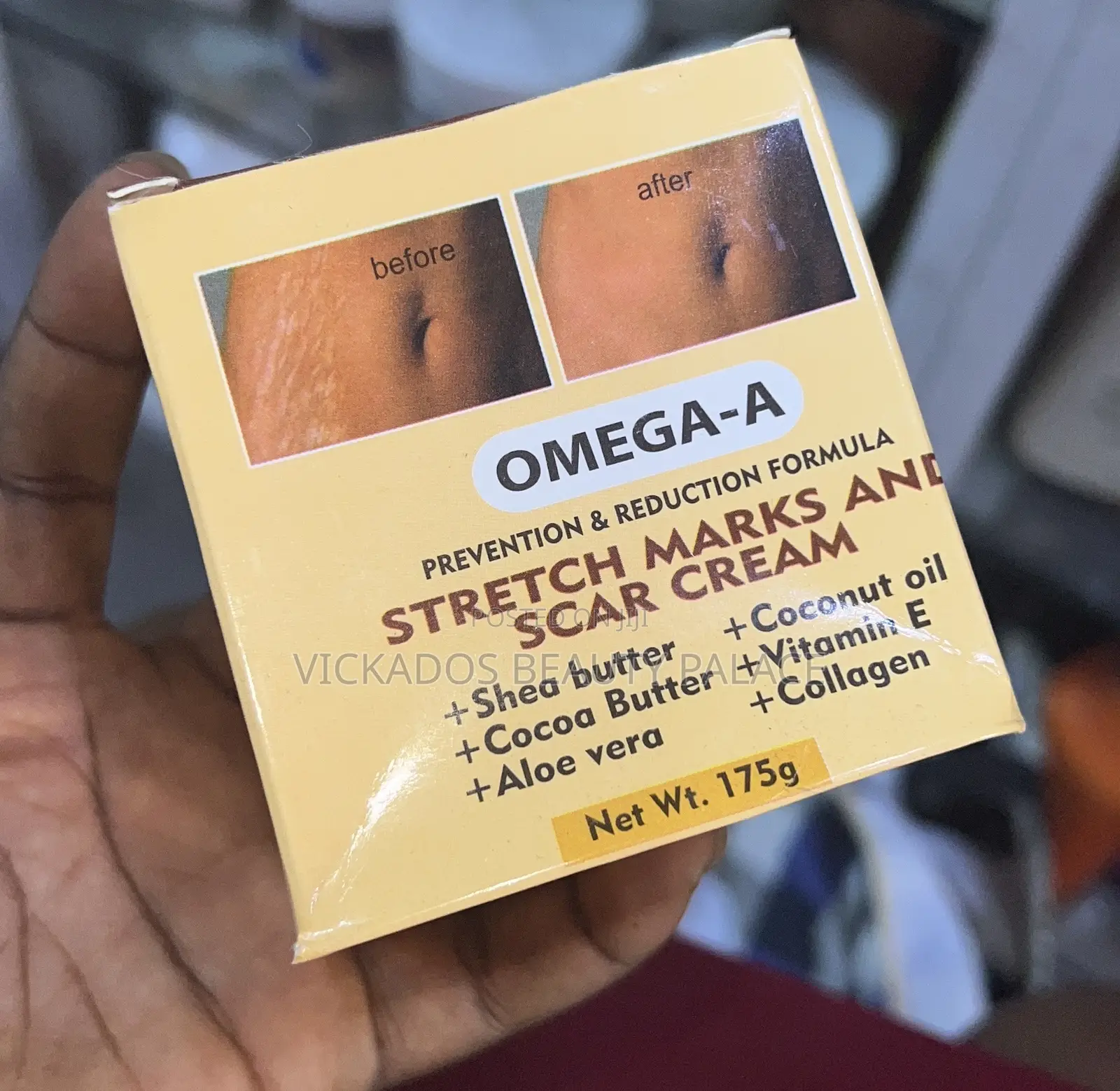 Omega-a Stretch Mark Cream