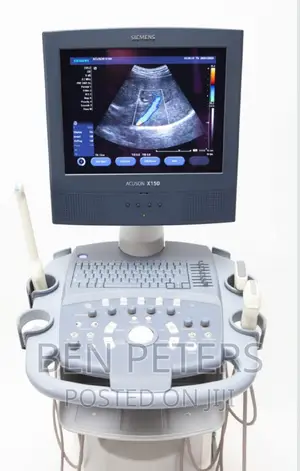 Siemens X150 Colour Doppler Ultrasound Scanning Machine