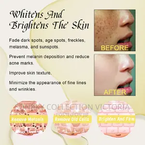 Black Spots Corrector Serum Skin Balanced Essence