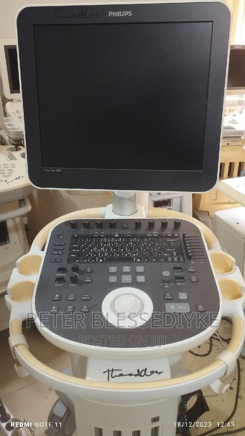 Philips Clearvue 650 (4D)