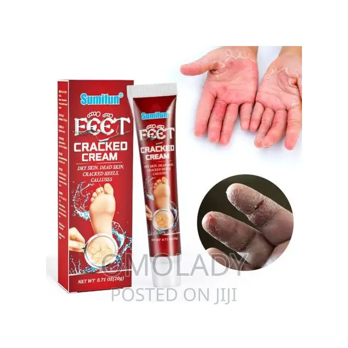 Sumifun Feet Cracked Foot Cream