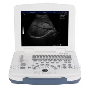 Laptop Ultrasound Machine