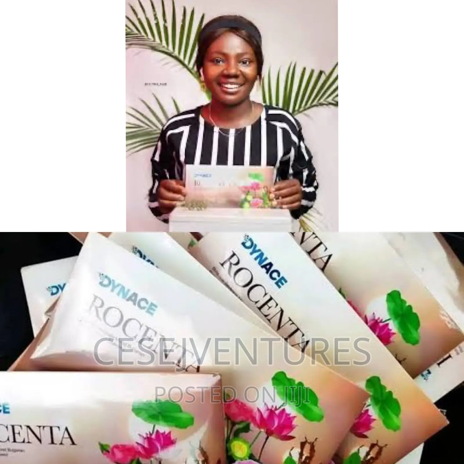 Dynace Stem Cell Therapy