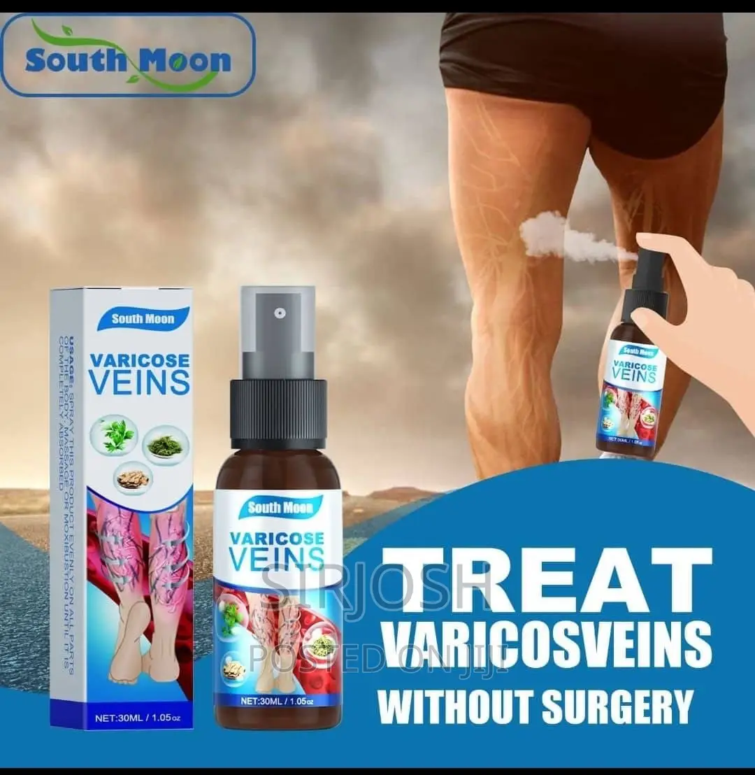 Varicose Veins