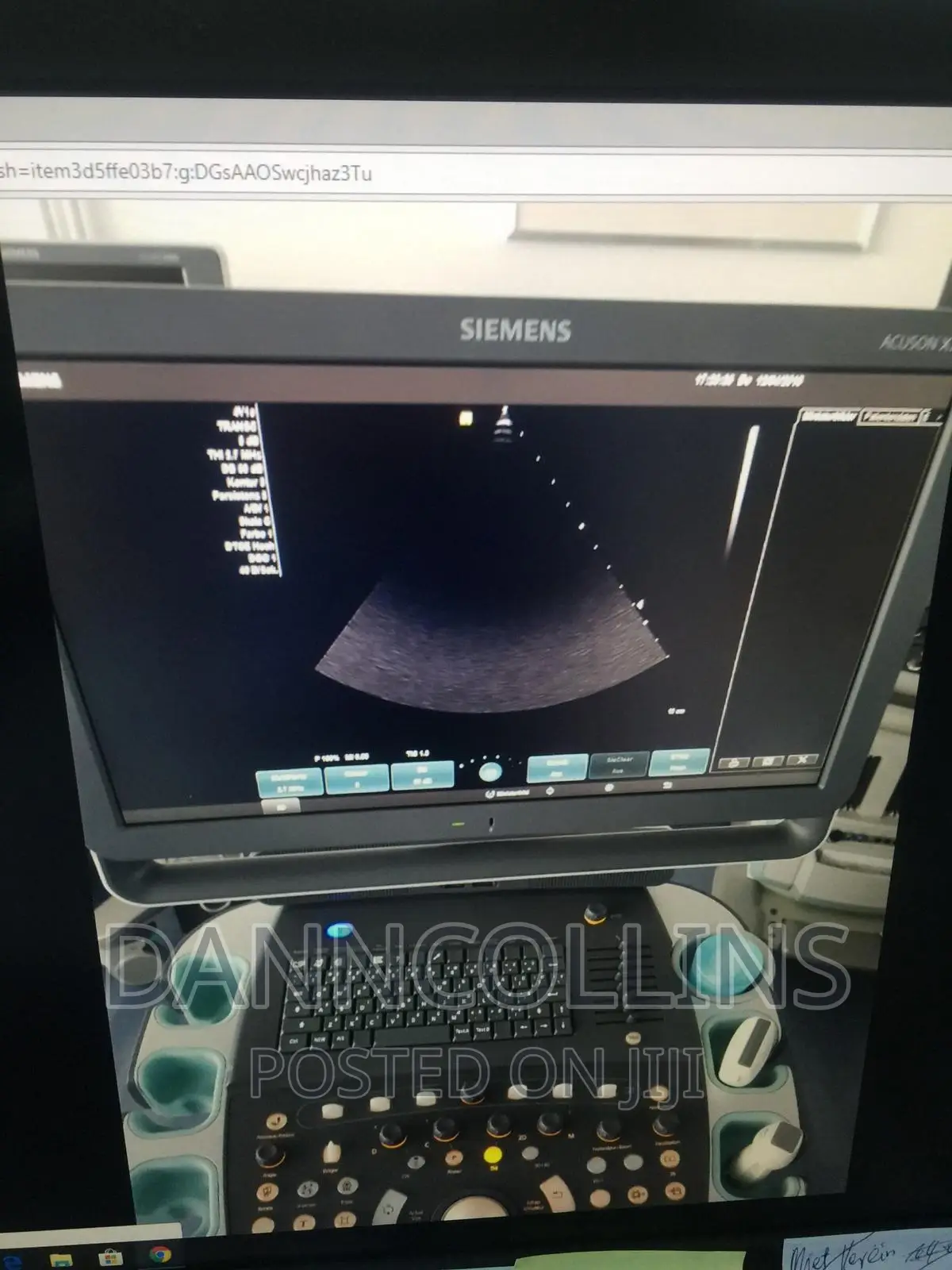 Siemens Acuson X700