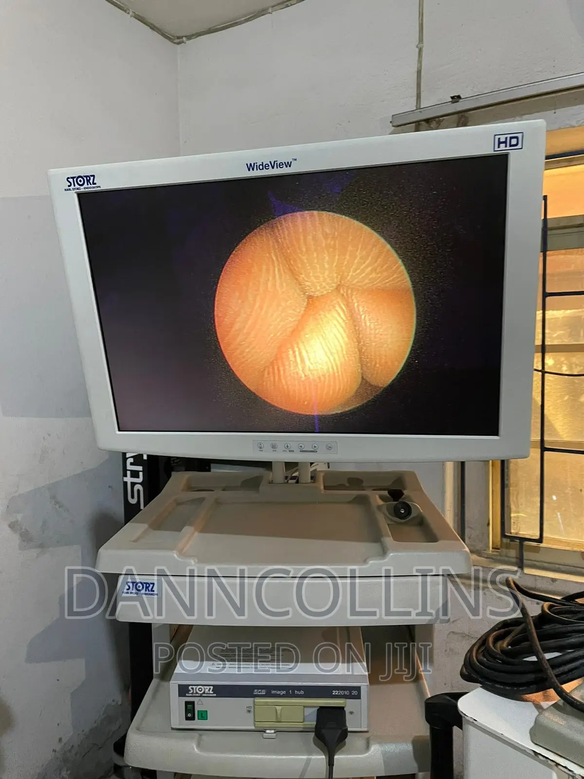 Karl Storz Image 1, Rigid Endoscope.