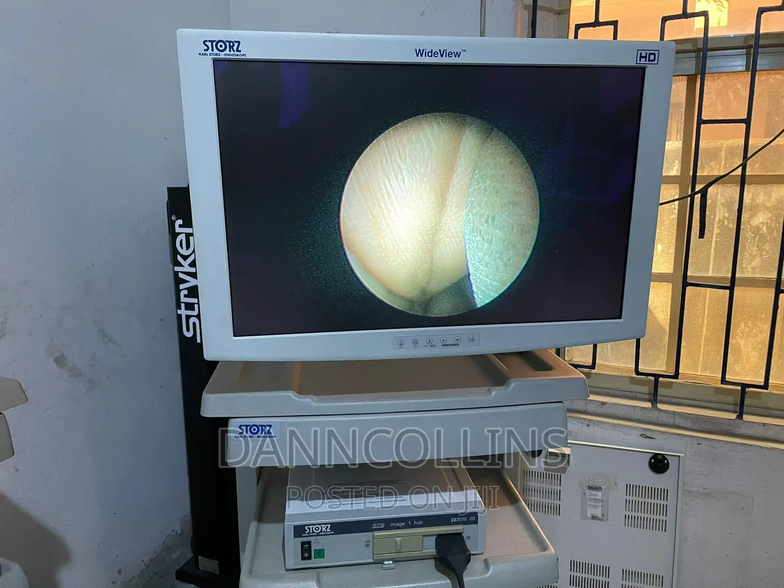 Karl Storz Image 1, Rigid Endoscope.