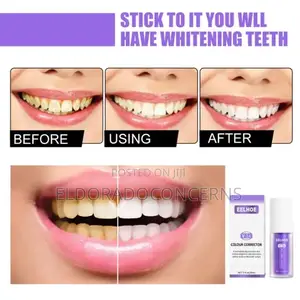 Teeth Color Corrector