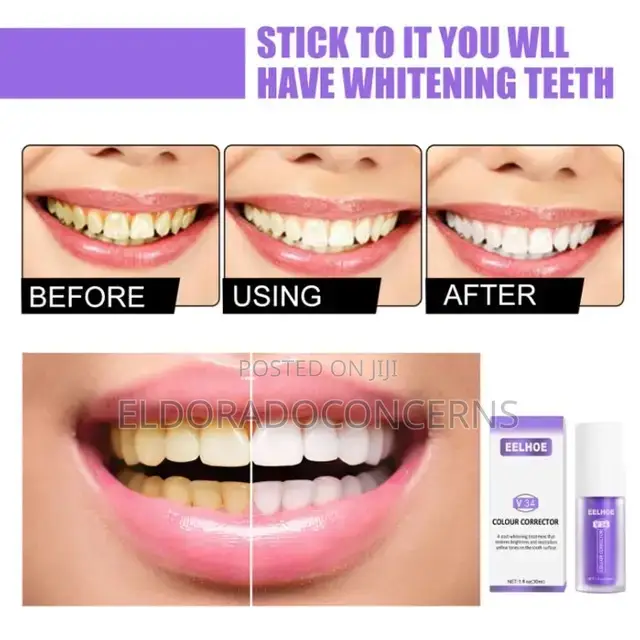 Teeth Color Corrector