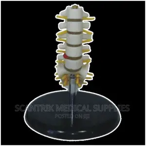 Medical Lumbar Vertebrae Model