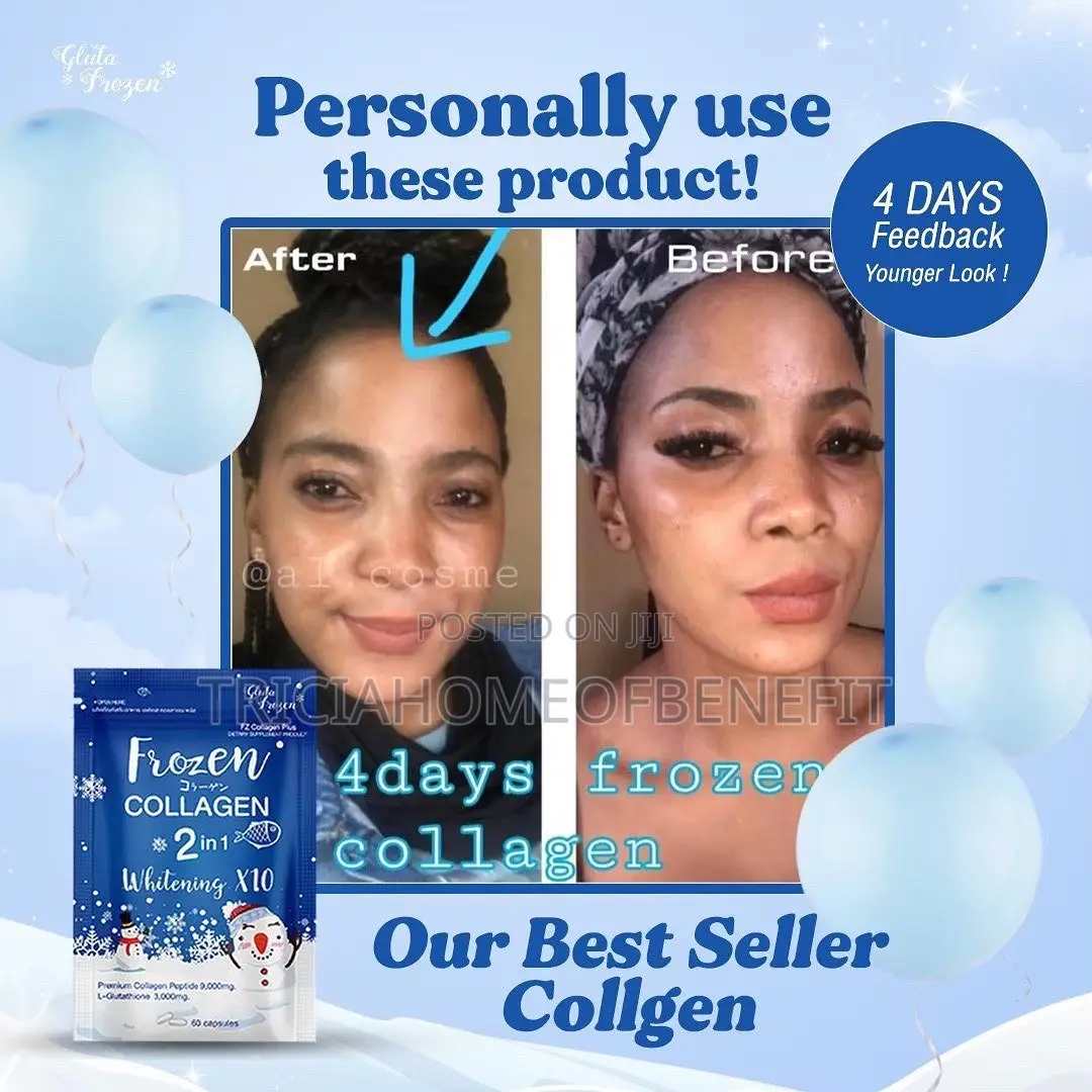 Frozen Collagen