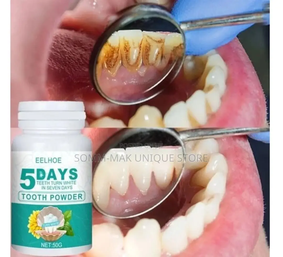 Eelhoe Tooth Whitening Teeth Powder - 50g