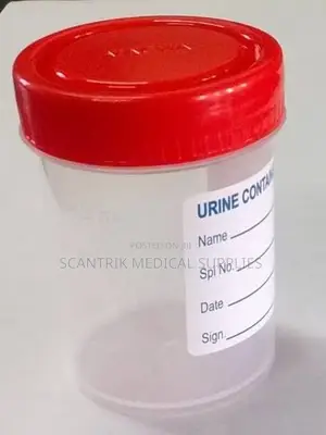 Urine Container With Label