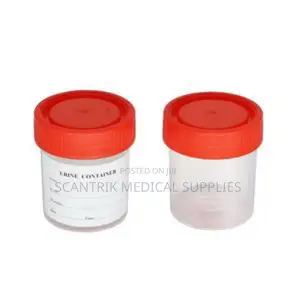Urine Cup 40ml,30ml,60ml,100ml,120ml